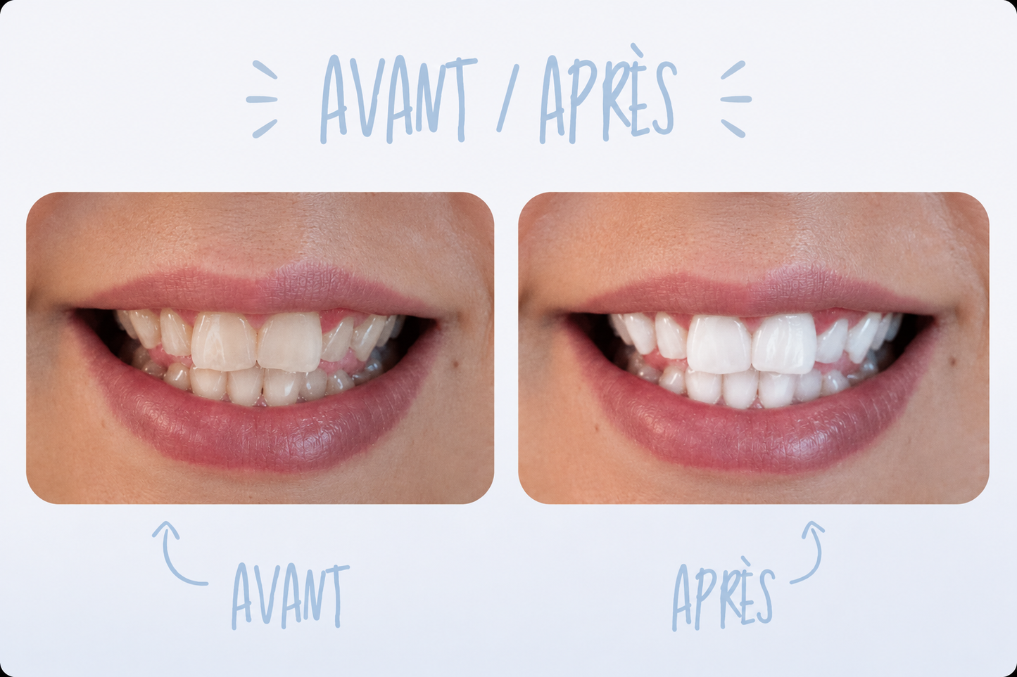 Dentifrice Black Power au charbon actif-115G